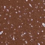 MAP6 Antibody in Immunohistochemistry (IHC)