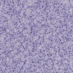 MAP6 Antibody in Immunohistochemistry (IHC)