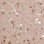 MAP1A Polyclonal Antibody