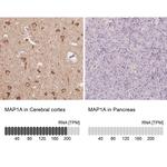 MAP1A Antibody in Immunohistochemistry (IHC)