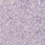 MAP1A Antibody in Immunohistochemistry (IHC)