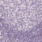 MAP1A Antibody in Immunohistochemistry (IHC)