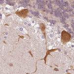 MAP1A Antibody in Immunohistochemistry (IHC)