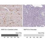 MAP1A Antibody in Immunohistochemistry (IHC)