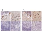 MAP1A Antibody in Immunohistochemistry (IHC)