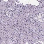 MAP1A Antibody in Immunohistochemistry (IHC)