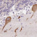 MAP1A Antibody in Immunohistochemistry (IHC)