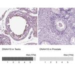 DNAH10 Polyclonal Antibody