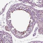 DNAH10 Antibody in Immunohistochemistry (IHC)