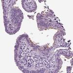 DNAH10 Antibody in Immunohistochemistry (IHC)