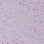 DNAH10 Antibody in Immunohistochemistry (IHC)