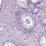 DNAH10 Antibody in Immunohistochemistry (IHC)