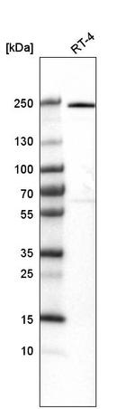 VWA8 Antibody in Western Blot (WB)