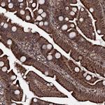 MRPS31 Antibody in Immunohistochemistry (Paraffin) (IHC (P))