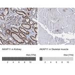 AKAP11 Polyclonal Antibody