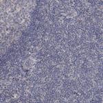 MUCL1 Polyclonal Antibody