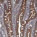 RITA1 Polyclonal Antibody