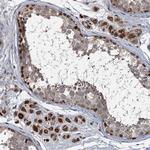 RITA1 Antibody in Immunohistochemistry (Paraffin) (IHC (P))