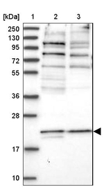 PIGQ Antibody in Western Blot (WB)