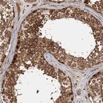 FAXC Antibody in Immunohistochemistry (Paraffin) (IHC (P))