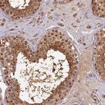 RSPH3 Antibody in Immunohistochemistry (IHC)