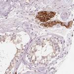 C1orf167 Antibody in Immunohistochemistry (Paraffin) (IHC (P))