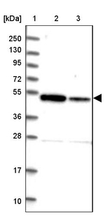 ZNF662 Antibody in Western Blot (WB)