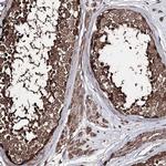 ZNF662 Polyclonal Antibody