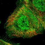 ZDBF2 Polyclonal Antibody
