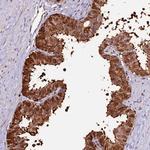 ZDBF2 Antibody in Immunohistochemistry (Paraffin) (IHC (P))