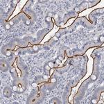 MYO7B Polyclonal Antibody