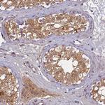 TMEM39A Antibody in Immunohistochemistry (IHC)