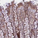 TMEM39A Antibody in Immunohistochemistry (IHC)