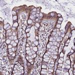 TMEM39A Antibody in Immunohistochemistry (IHC)