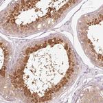 HSPA4L Antibody in Immunohistochemistry (Paraffin) (IHC (P))