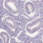 HSPA4L Antibody in Immunohistochemistry (IHC)