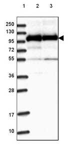 HSPA4L Antibody in Western Blot (WB)