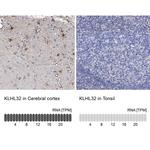 KLHL32 Antibody in Immunohistochemistry (IHC)