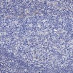 KLHL32 Antibody in Immunohistochemistry (IHC)