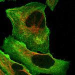 DQX1 Antibody in Immunocytochemistry (ICC/IF)