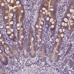 DQX1 Antibody in Immunohistochemistry (Paraffin) (IHC (P))