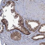 PHC3 Antibody in Immunohistochemistry (Paraffin) (IHC (P))