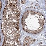 PHC3 Antibody in Immunohistochemistry (Paraffin) (IHC (P))