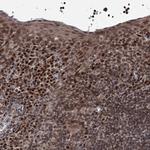PHC3 Antibody in Immunohistochemistry (Paraffin) (IHC (P))