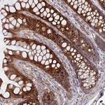 Cyclophilin C Polyclonal Antibody