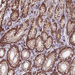 KCT2 Antibody in Immunohistochemistry (Paraffin) (IHC (P))