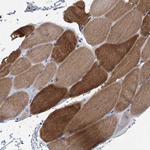 MYOZ3 Polyclonal Antibody