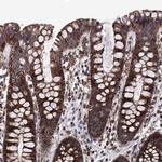 FGFBP2 Polyclonal Antibody