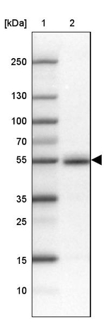 FAM149B1 Antibody in Western Blot (WB)