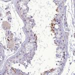FAM149B1 Antibody in Immunohistochemistry (IHC)